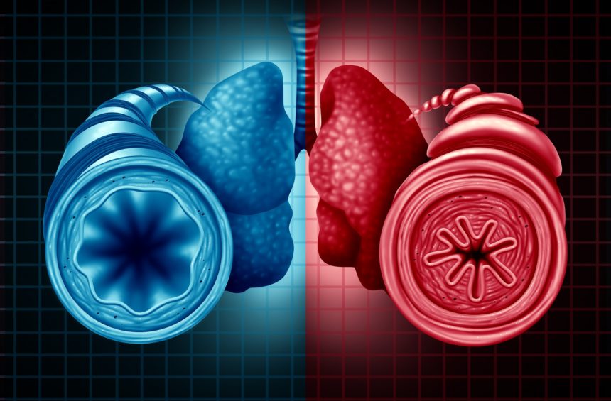 Speciality Clinic – Asthma & COPD